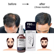 FEG Plus Hair Growth Serum Hair-loss Treatment 14 Days Best Ginger Anti Hair Loss Serum