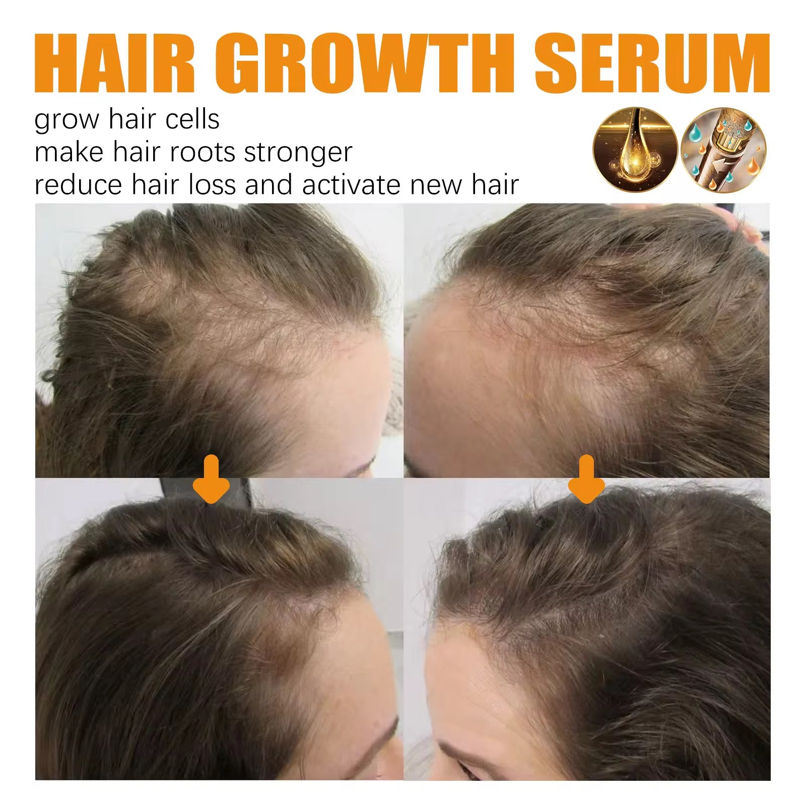 Biotin spray for rapid hair growth, anti-hair loss serum scalp treatment 30ml